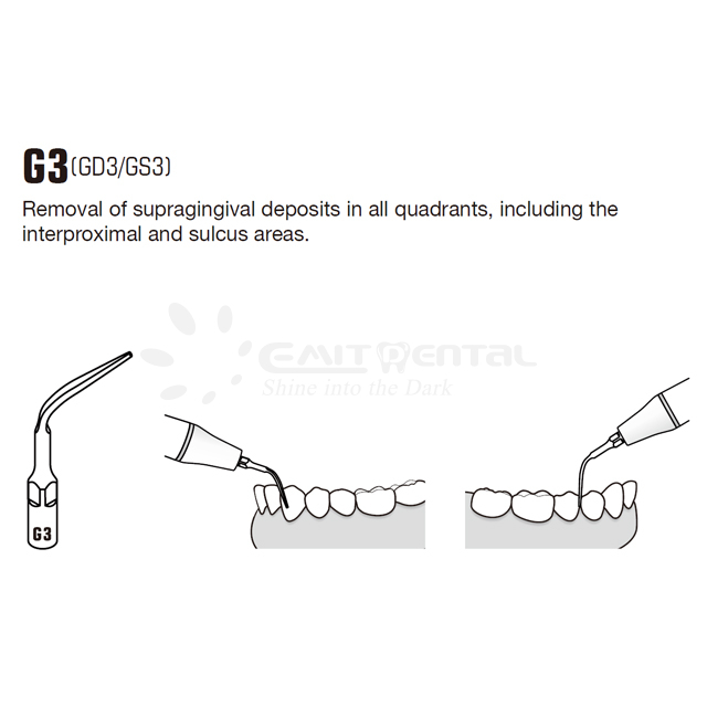 Ultrasonic Scaler Tip GD3 for Satelec NSK