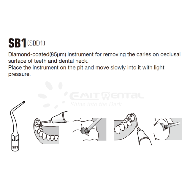 Cavity Preparation Scaling Tip SB1 For EMS