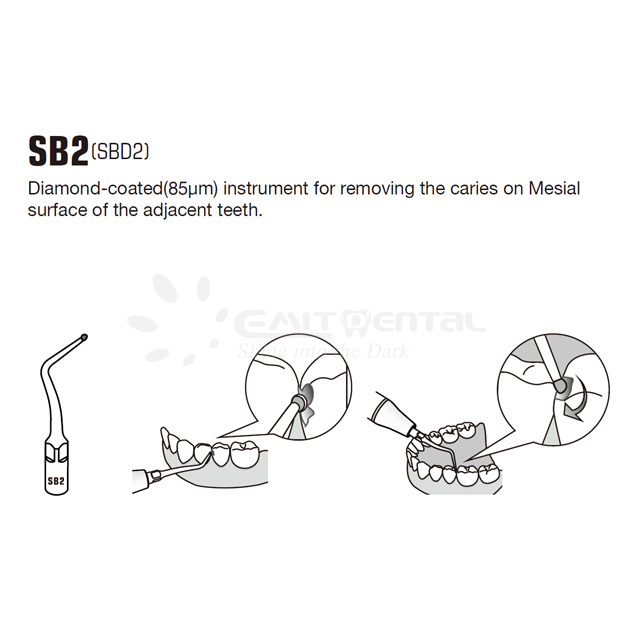 Cavity Preparation Scaling Tip SB2 For EMS